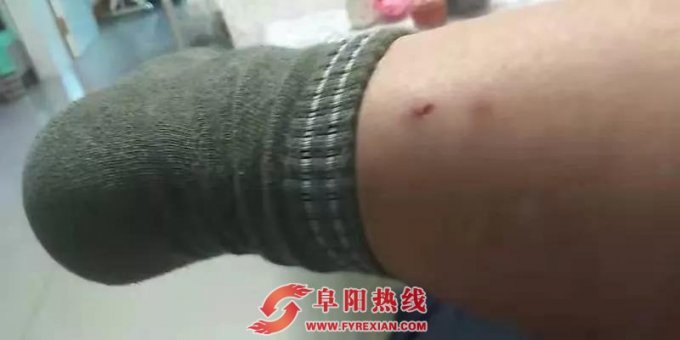 阜城街头流浪狗咬人，特警到达现场并击毙